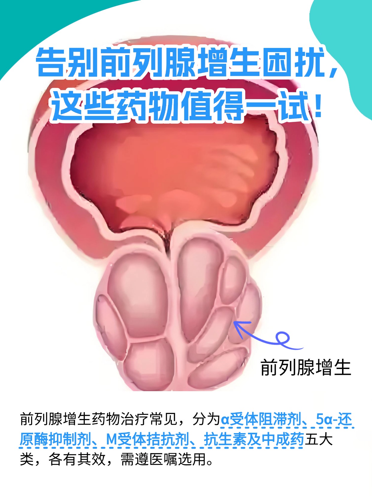 专家:中国快速迈入“深度老龄化社会”,多数患者对前列腺增生认知不足